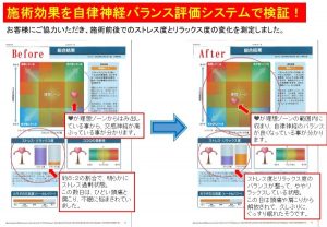 施術効果を自律神経バランス評価システム『ココロみーる』で測ってみました。その結果には参りました